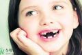 小孩蛀牙牙痛怎么办 蛀牙牙痛如何止痛