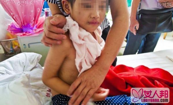 4岁女孩遭伤害 暴力虐待下体撕裂血淋淋触目惊心
