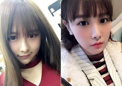 SNH48唐安琪首回应烧伤:系自己不小心与人无尤唐安琪烧伤照片流出