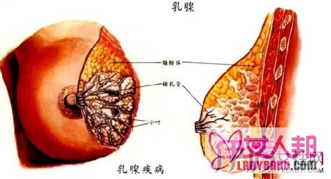 乳房纤维瘤的病因有哪些？ 得了乳房纤维瘤怎么办？