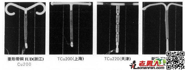 >图揭女性上环避孕全过程【组图】