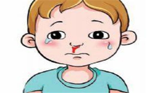儿童流鼻血有何危害？治疗要及时