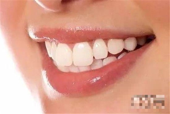 >牙齿黄如何变白 牙齿黄是什么原因