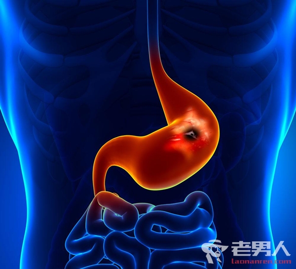 >胃病癌变有什么征兆 哪些胃病容易发生癌变