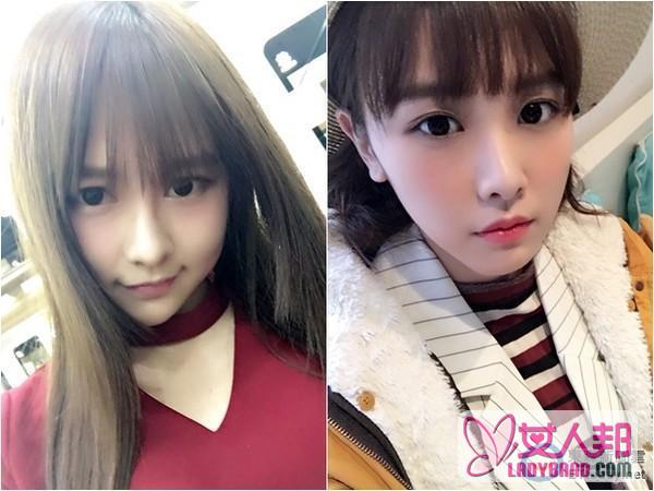SNH48唐安琪完成脸部植皮手术 已接受3次手术 唐安琪妈妈、公司宣传人员、女团成员接受采访怎么说(图)