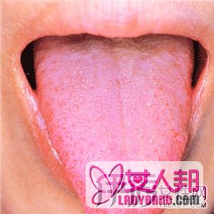 >介绍健康的舌头图片 教你从舌头看你的健康
