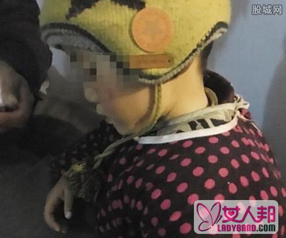 双性弃婴北京求医 患有“先天性生殖器两侧畸形症”