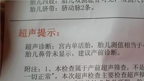 >鼻梁骨眼睛疼 打断乘客鼻梁骨 网约车司机获刑