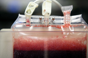 【脐带血】脐带血保存费用_脐带血有必要保存吗_脐带血的作用