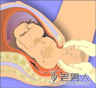 孕妇难产 婴儿卡住无法生出医生斩断婴儿头颅救人