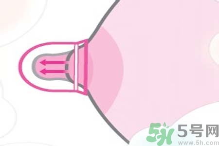 >乳头内陷可以用吸奶器吗？乳头内陷能不能用吸奶器？