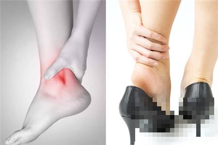 左脚踝肿是什么原因  是否是这八大病症之一