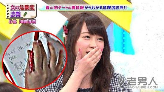 >日本女团成员川荣李奈遇袭 右手伤疤长达10公分