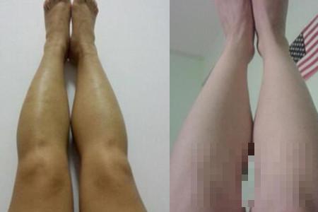 >小腿肌肉怎么减备受女性关注 几个方法助大家拥有苗条身材