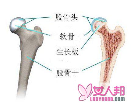 股骨头坏死食疗方