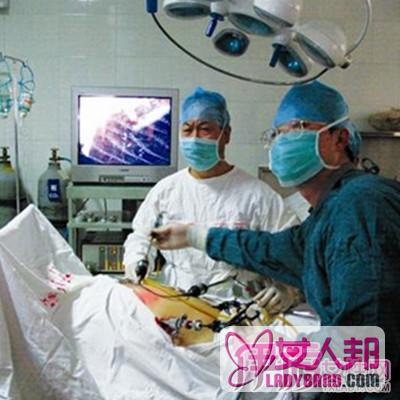 腹腔镜手术过程曝光 腹腔镜手术六大特点揭晓