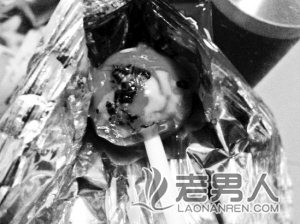 >6岁男童吃棒棒糖七窍流血而亡