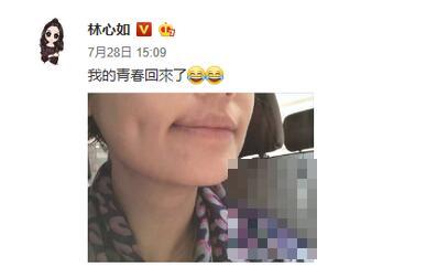 42岁林心如下颌长痘晒自拍 自侃：我的青春回来了