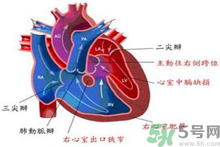 先天性心脏病需要注意什么？