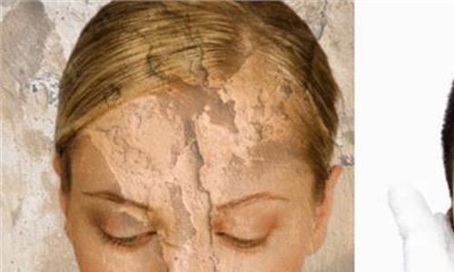 皮肤干燥如何改善 如何改善皮肤干燥