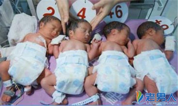 意外同卵四胞胎幸运降生  概率竟为50万分之一