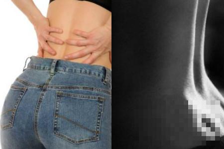 腰窝酸痛小腹下坠是怎么回事 几个因素你要了解