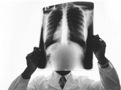 >肺癌的早期症状 发现肺癌早期的六大信号