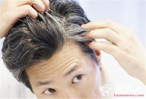 >解析年轻人为何会长白头发 预防白头发有哪些好方法