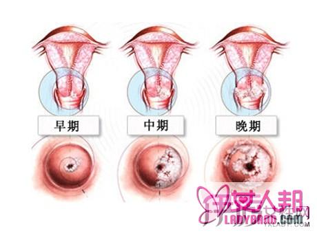 >女性常见疾病有哪些？治疗方法为你大揭秘