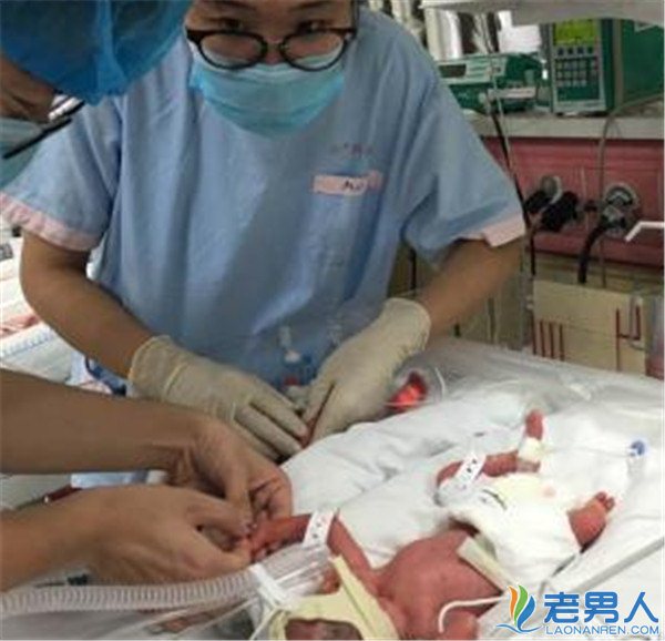 同卵四胞胎降生在上海诞生 母女都平安