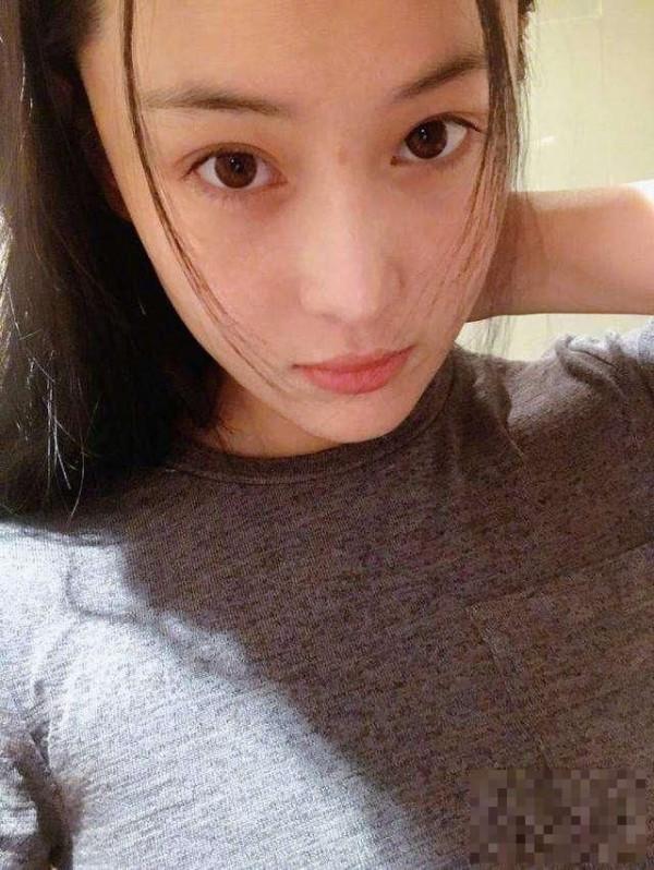 林心如baby张馨予长痘拉低颜值，蔡依林脸上这痘印太厚实了