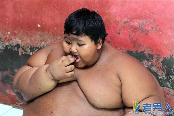 世界最重的男孩仅10岁重384斤 食量是成年人的两倍