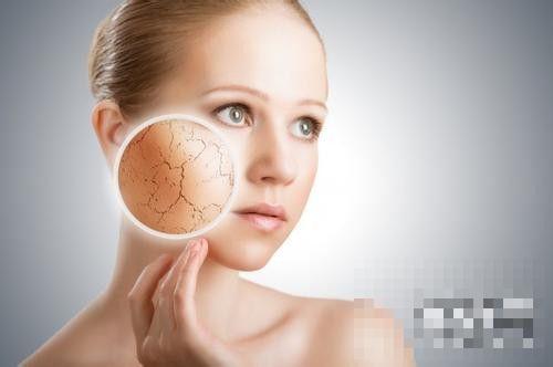 >敏感性肌肤用什么牌子护肤品 敏感性肌肤怎么改善