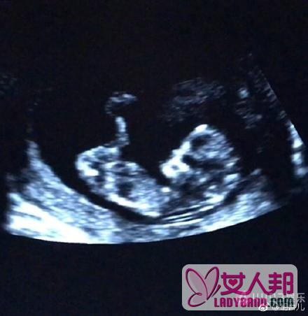 胡杏儿母亲节当天宣布怀孕三个月 与黄宗泽为什么分手 (/)