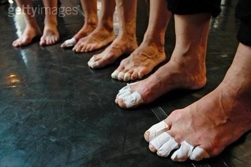 >【芭蕾舞演员的脚趾】芭蕾演员的脚趾怎么保养