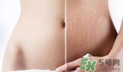 >妊娠纹什么时候长出来？哪种皮肤容易长妊娠纹？