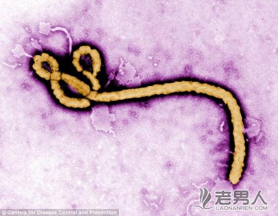 >世卫组织：埃博拉病毒可在精液中存活82天