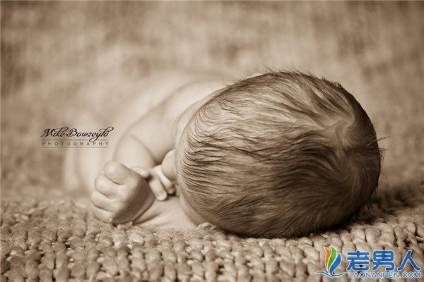 >新生儿脑水肿会不会影响发育 它的早期症状有哪些