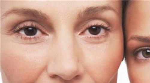 眼霜的正确使用方法 眼霜早晚都要用吗 损害眼部的眼霜误区大剖析