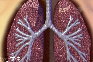 肺大泡怎么治疗 最好选择手术