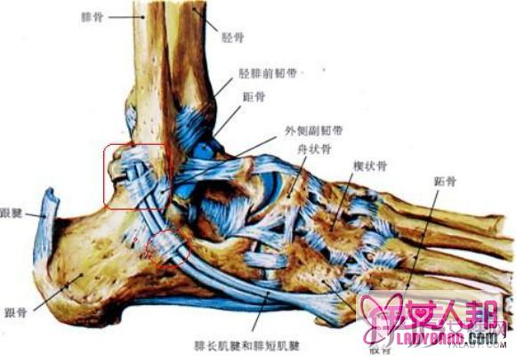 脚踝两侧酸痛怎么办？ 谨慎！痛风的侵害不容忽视