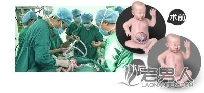 孕妇做产检 发现腹中胎儿内脏全在体外