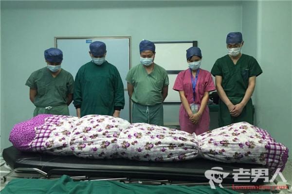 21岁女子生双胞胎后离世 捐献器官成功救助四人