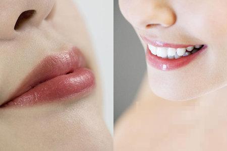为什么唇部有白色颗粒 一定要知道的几个原因