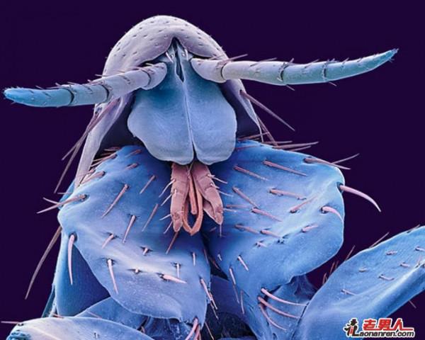 >昆虫在显微镜下令人毛骨悚然的照片【组图】