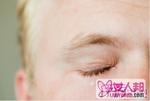 过敏性结膜炎眼药水图片 最常见的眼表疾病之一的治疗与预防