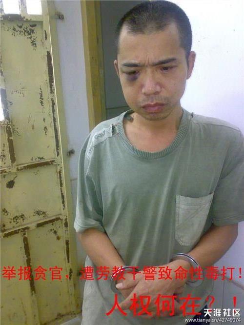 >香港《中国观察》主编王寒非先生在郴州监狱遭毒打