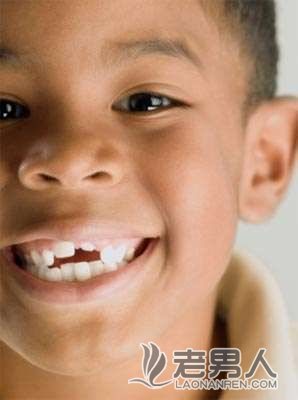 >儿童牙外伤治疗和护理方法