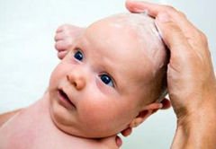 宝宝头上长乳痂是怎么回事怎么去除