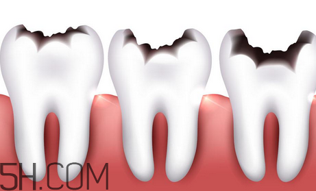 牙齿不好会引发哪些疾病？怎样保持牙齿健康？